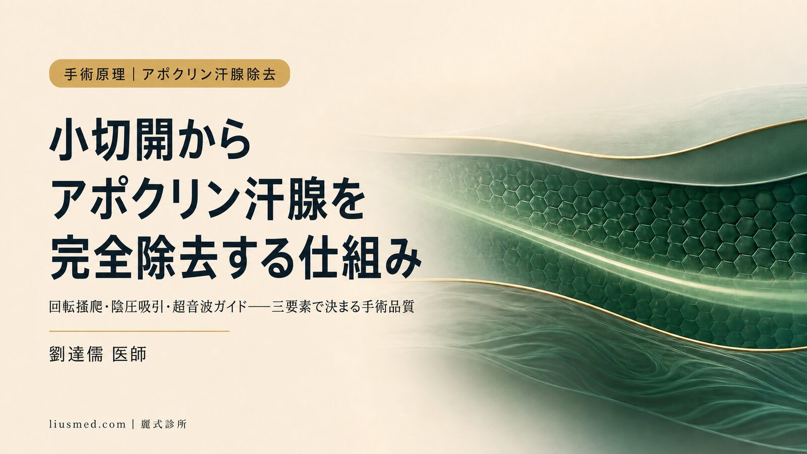 ロータリーカッター式わきが手術の原理:小切開でアポクリン汗腺を完全除去する仕組み
