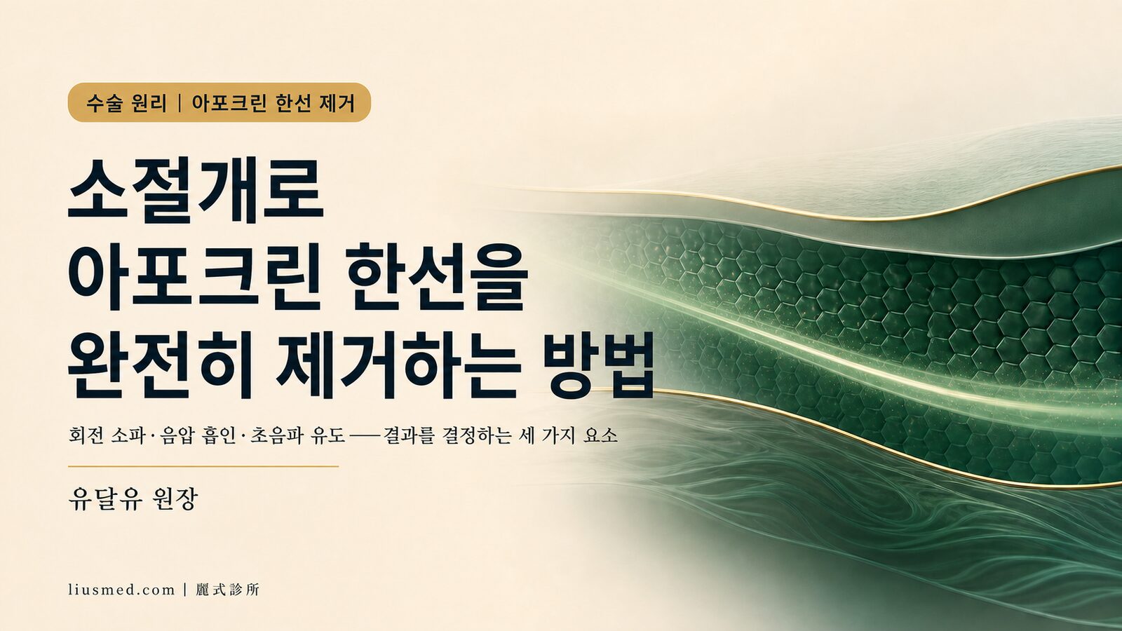 회전칼 액취증 수술 원리 완전 해설:소절개로 아포크린 한선을 완전히 제거하는 방법