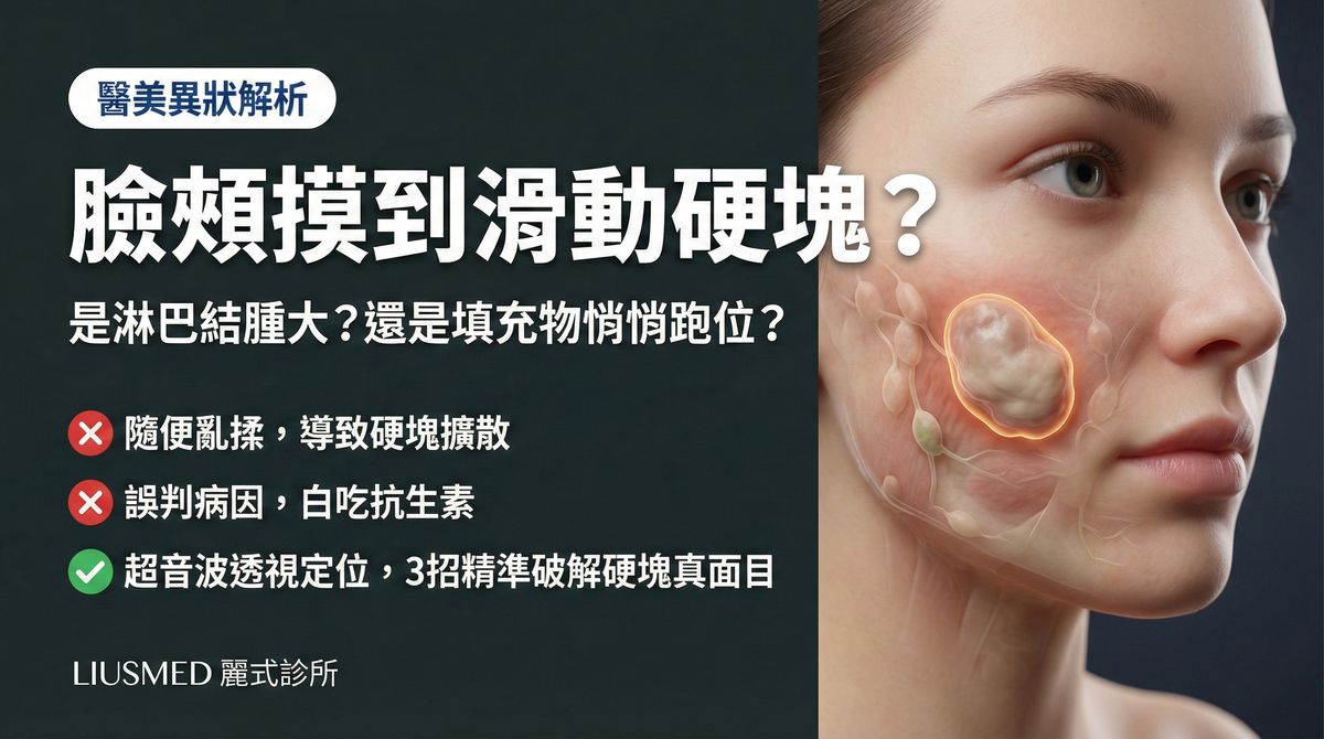臉頰摸到滑動的硬塊,是淋巴結還是填充物跑位?3招自我判斷