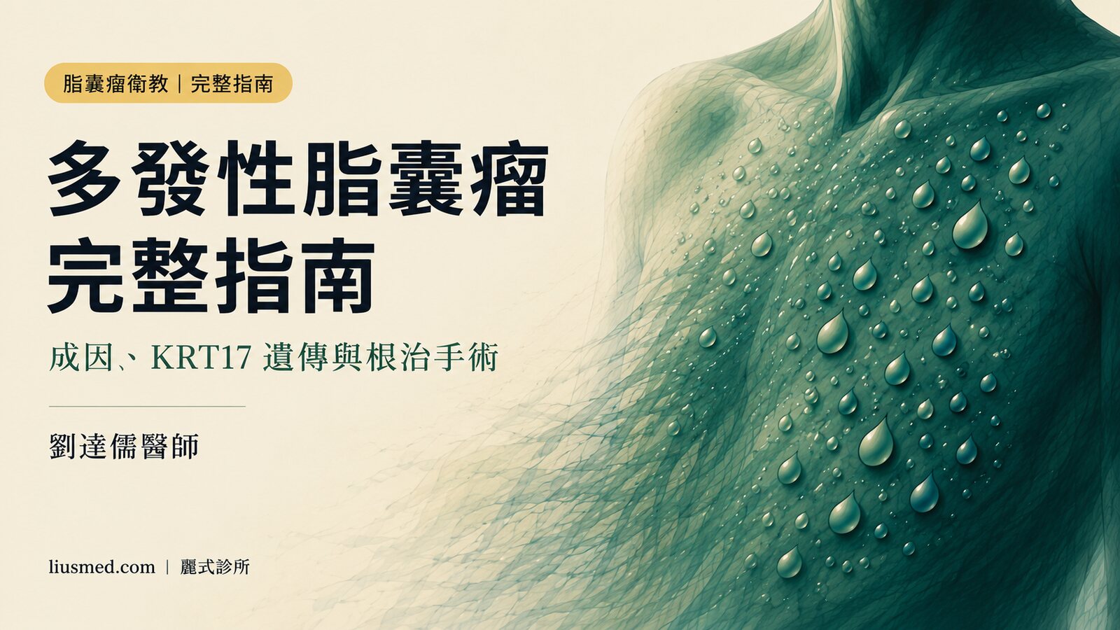 多發性脂囊瘤完整指南:成因、KRT17 遺傳、反覆發炎與根治手術