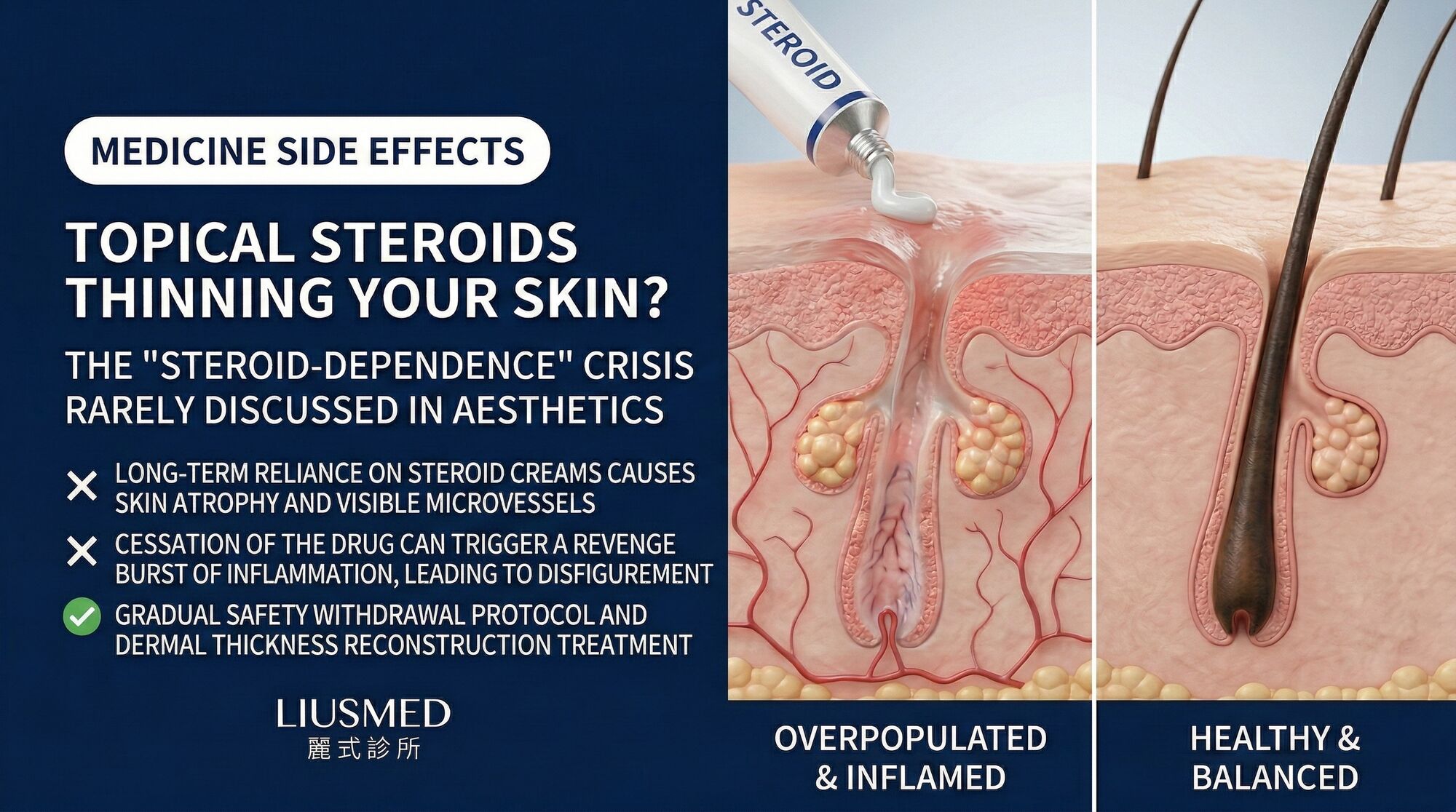 Steroid-Thinned Skin That Won't Heal? The Steroid-Dependent Rosacea Crisis Nobody Talks About