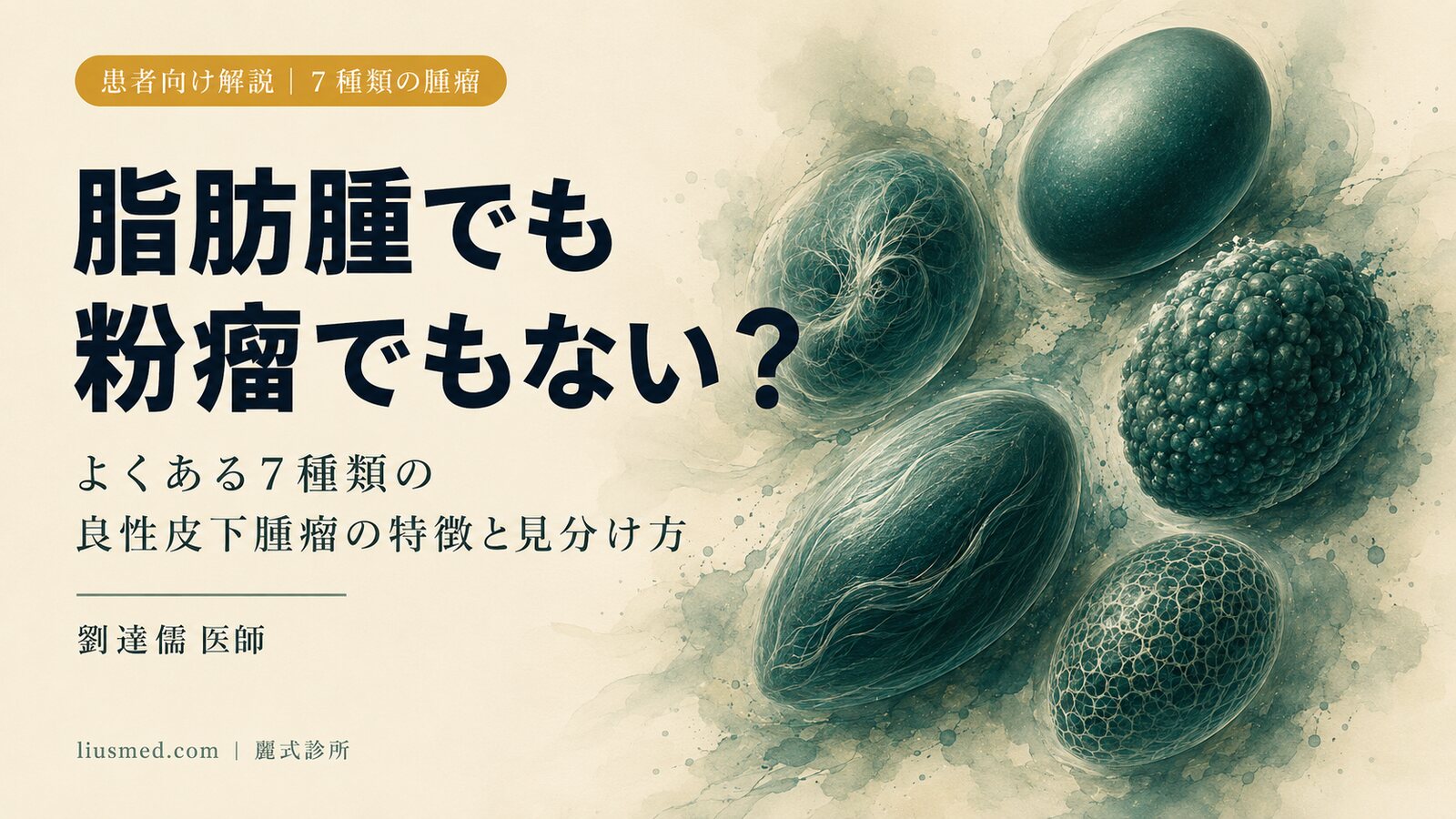 皮下のしこりは脂肪腫・粉瘤だけじゃない:よくある良性軟部腫瘤の見分け方まとめ
