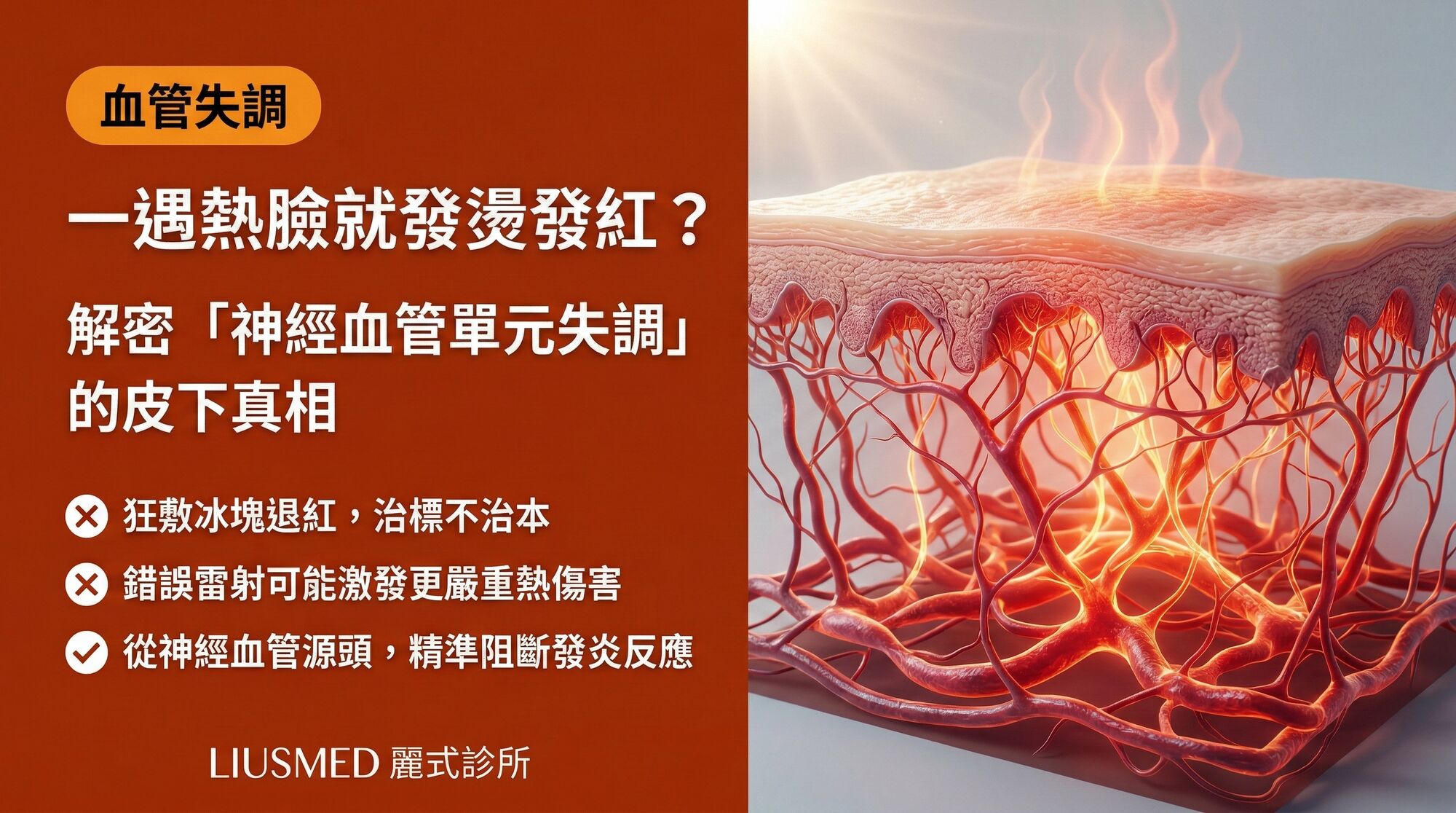 為什麼只要一曬太陽或悶熱,臉就發燙發紅?解密「神經血管單元失調」