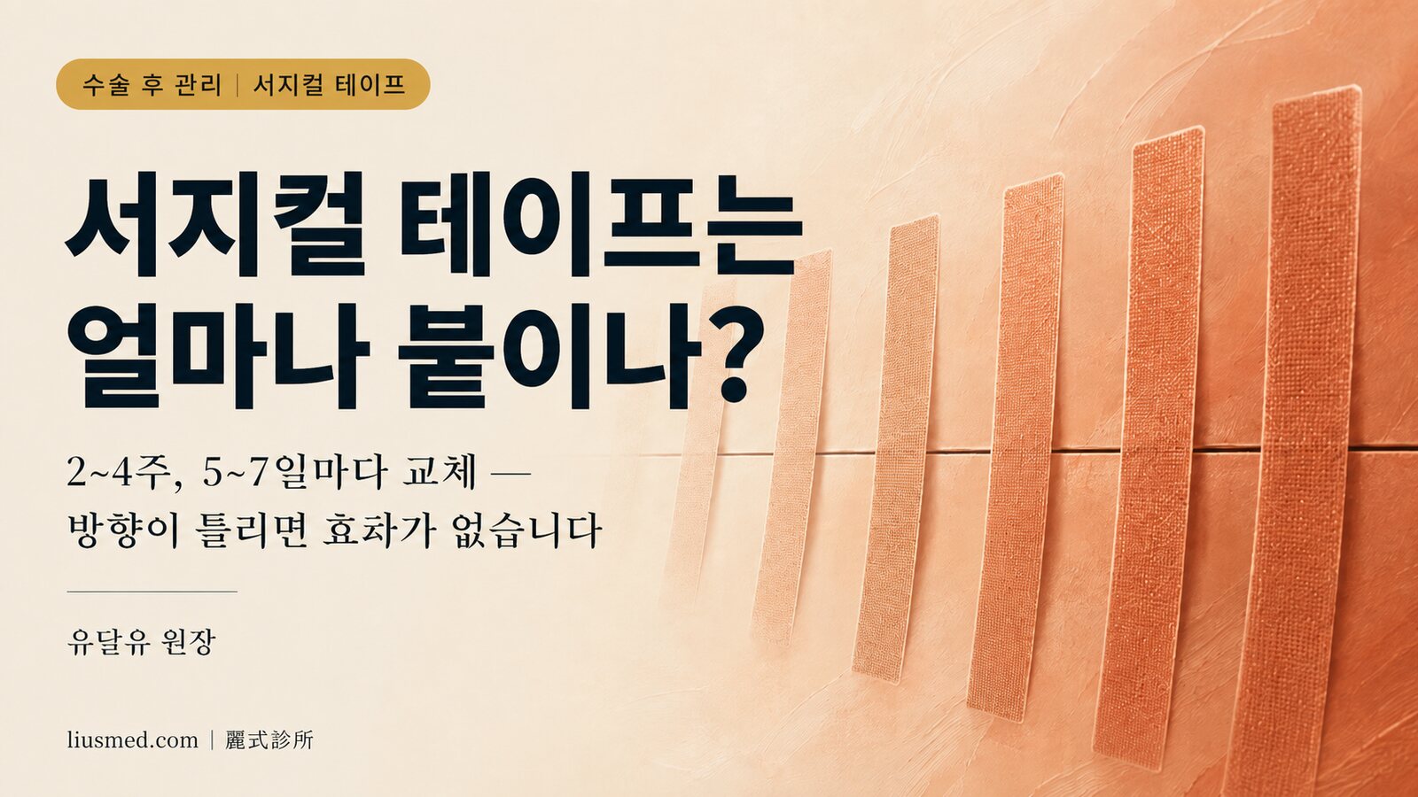 서지컬 테이프는 얼마나 붙이나? 제왕절개는 3개월, 일반 상처는 2~4주