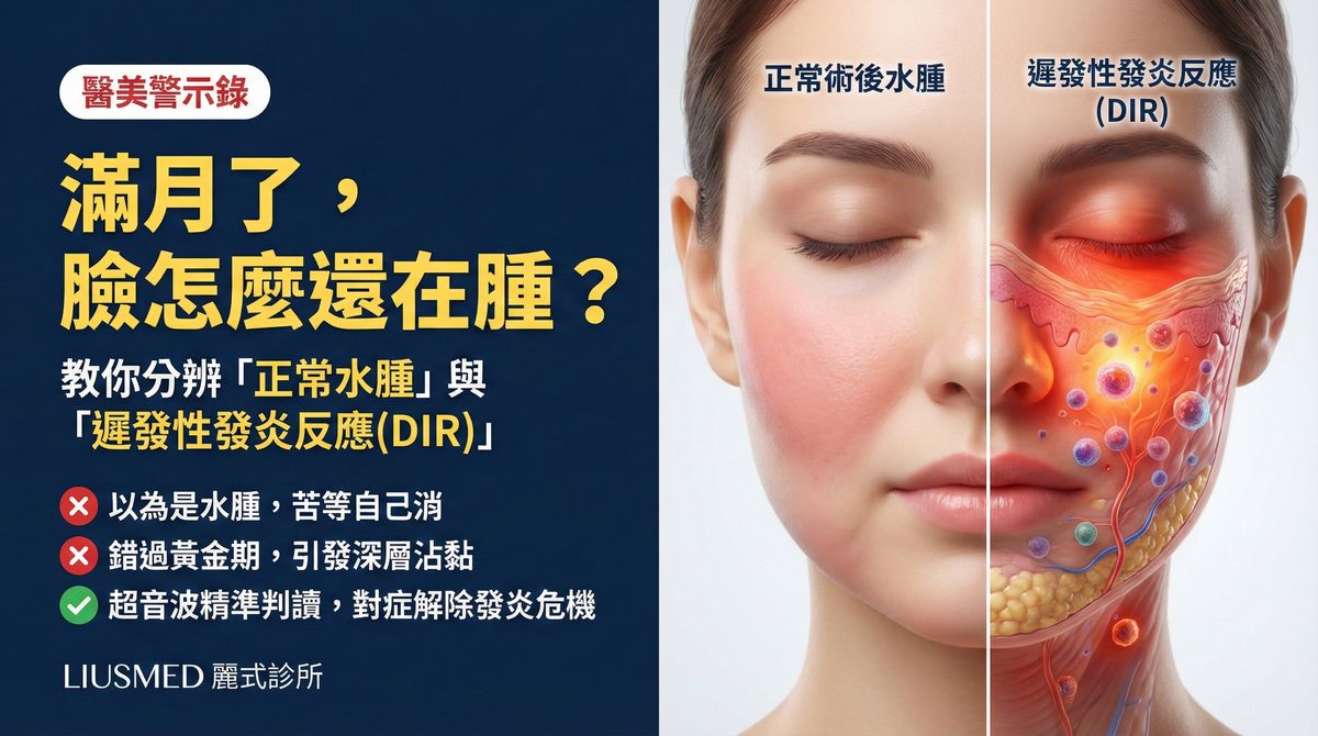 打完微整一個月臉還是腫的?教你分辨術後水腫與遲發性發炎反應(DIR)