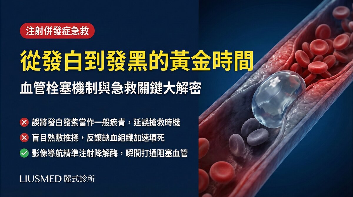 血管栓塞的機制:從發白到發黑的急救黃金時間