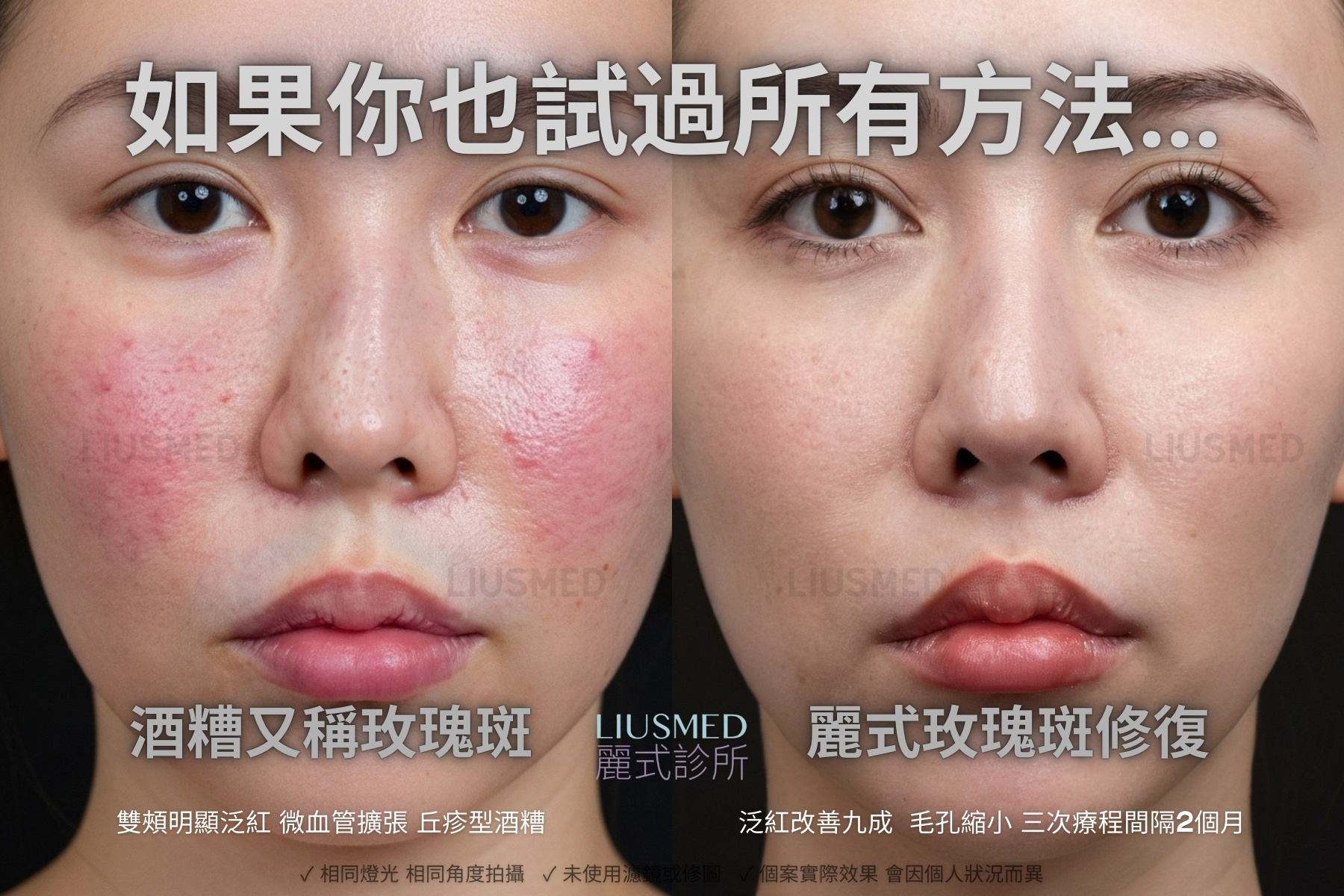 皮膚修復 - 全臉 術前