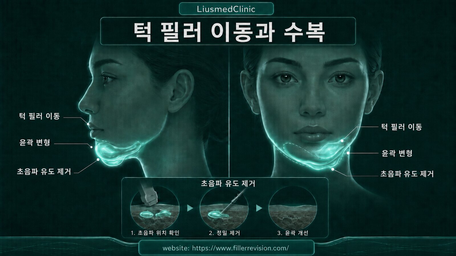 턱
