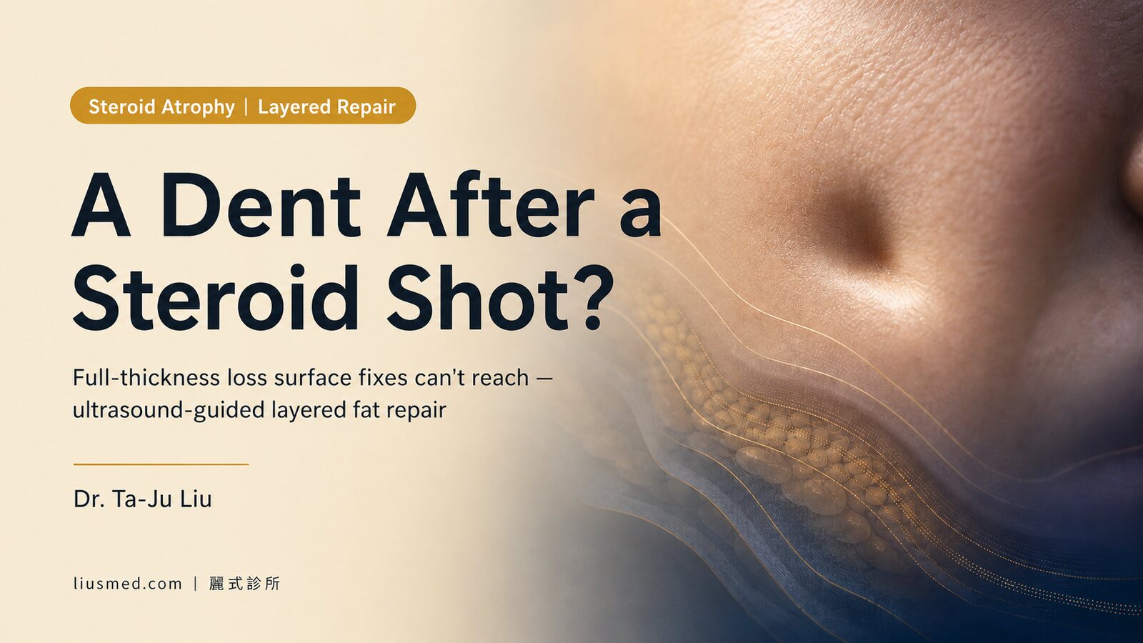 Steroid Injection Atrophy