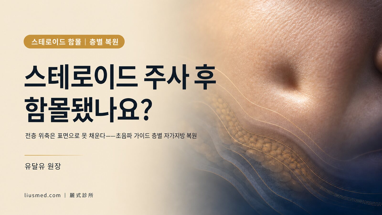 스테로이드 주사 함몰·위축