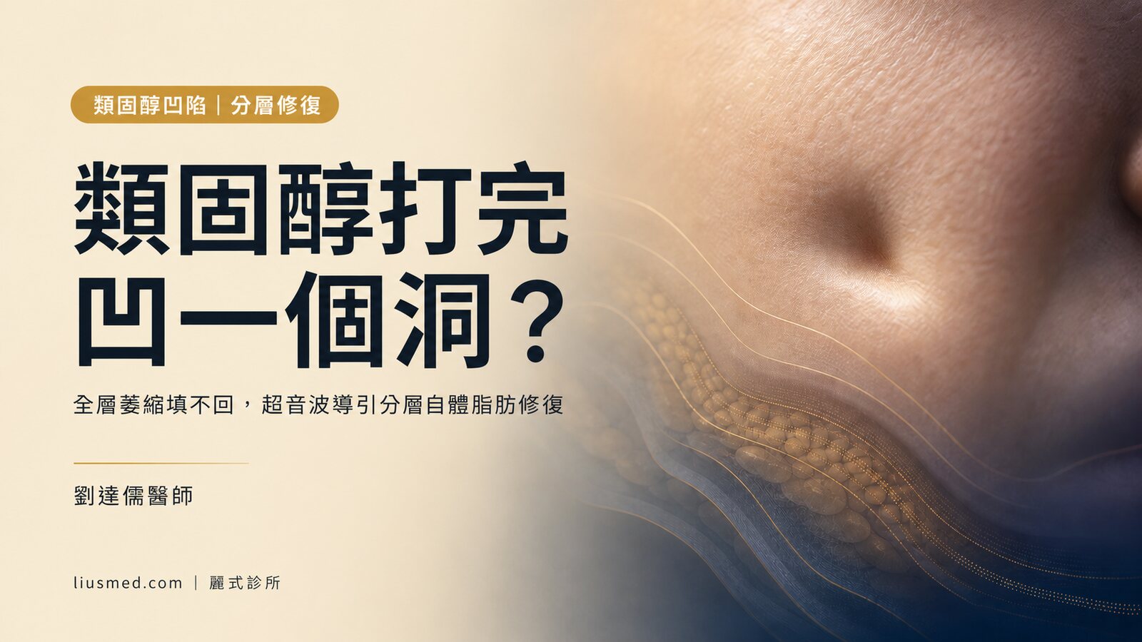 類固醇注射凹陷萎縮