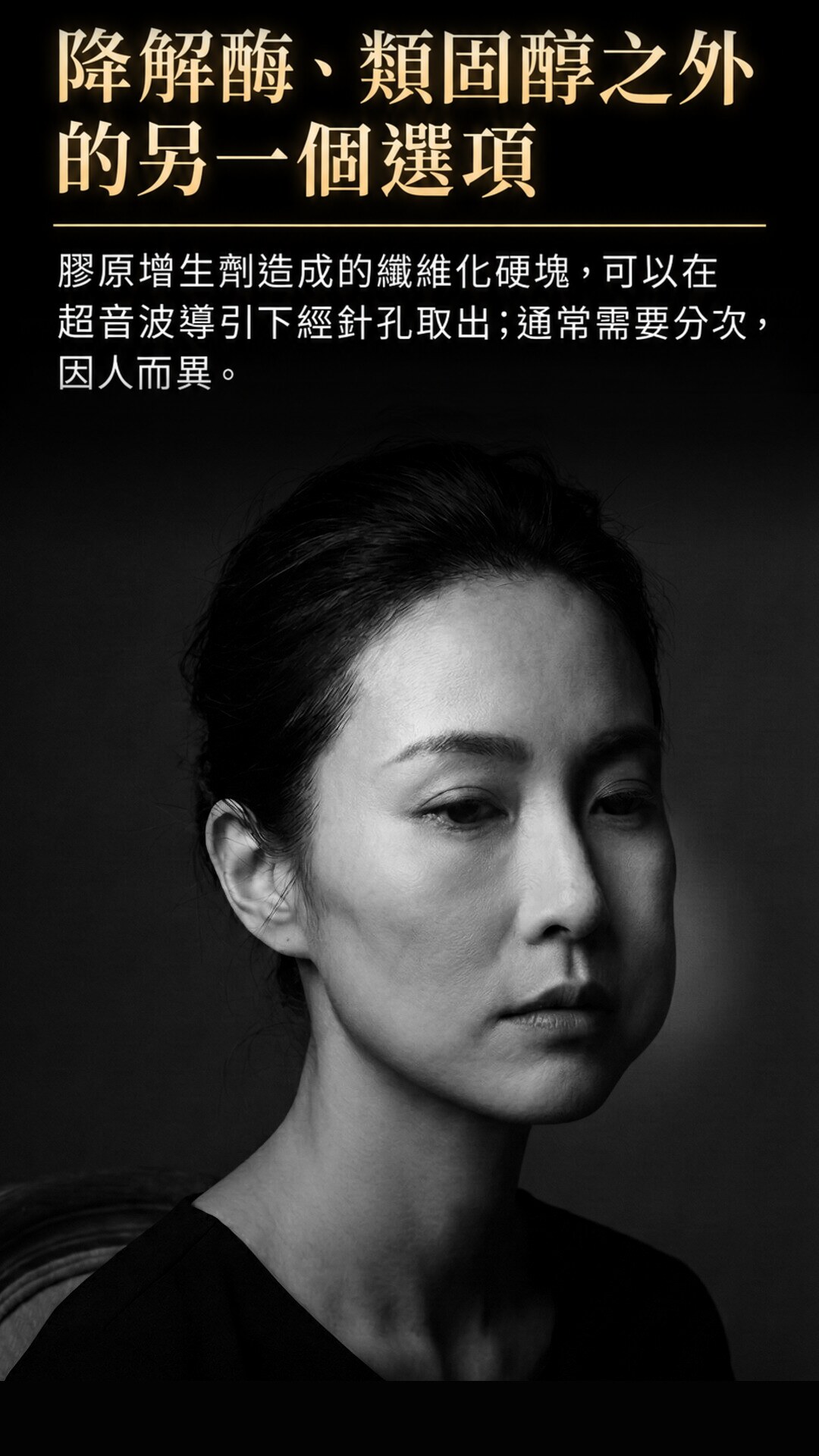 降解酶、類固醇之外的另一個選項:超音波導引下經針孔取出纖維化硬塊