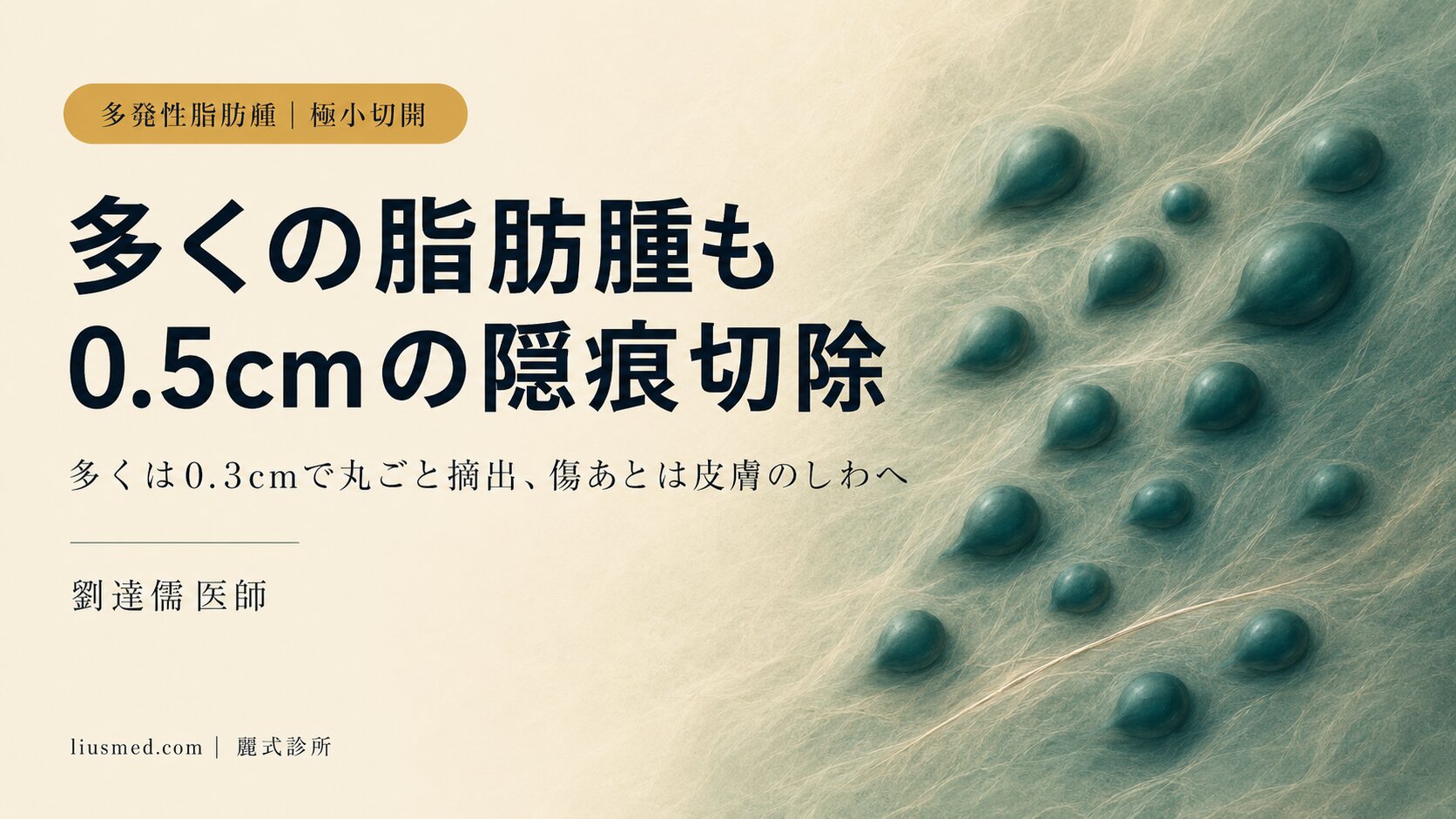 多発性脂肪腫