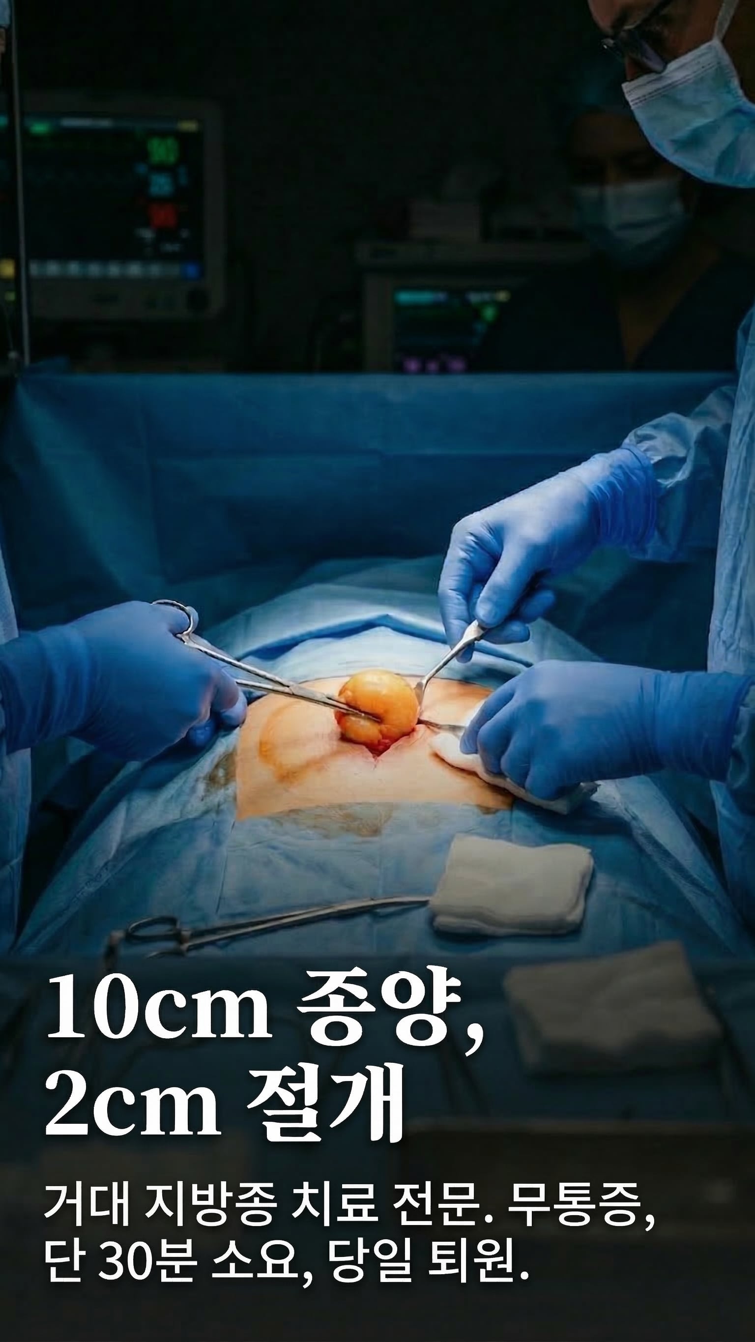 10cm 종양, 2cm 절개 — 거대 지방종 치료 전문.