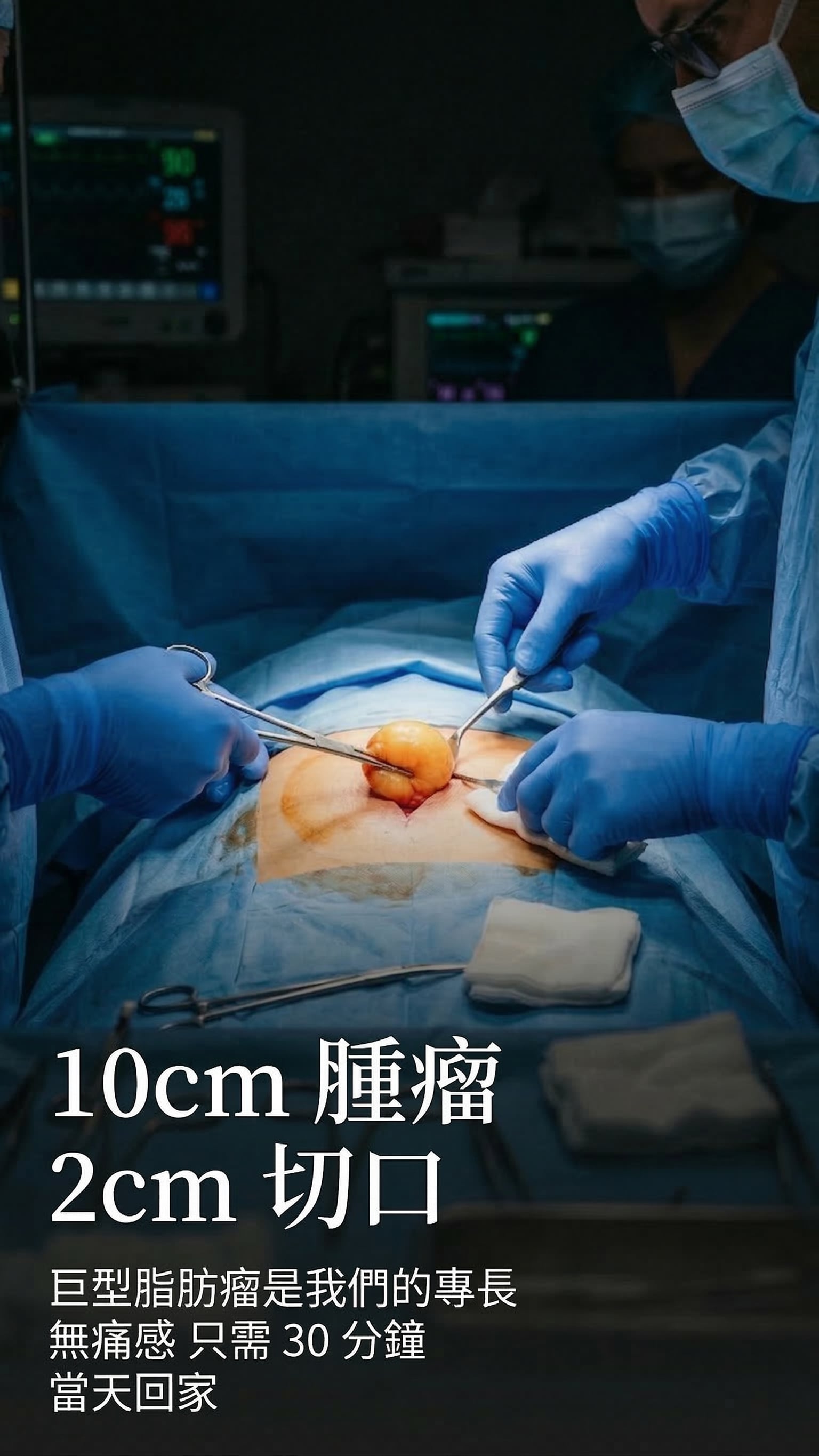 10cm 腫瘤 2cm 切口 — 巨型脂肪瘤是我們的專長