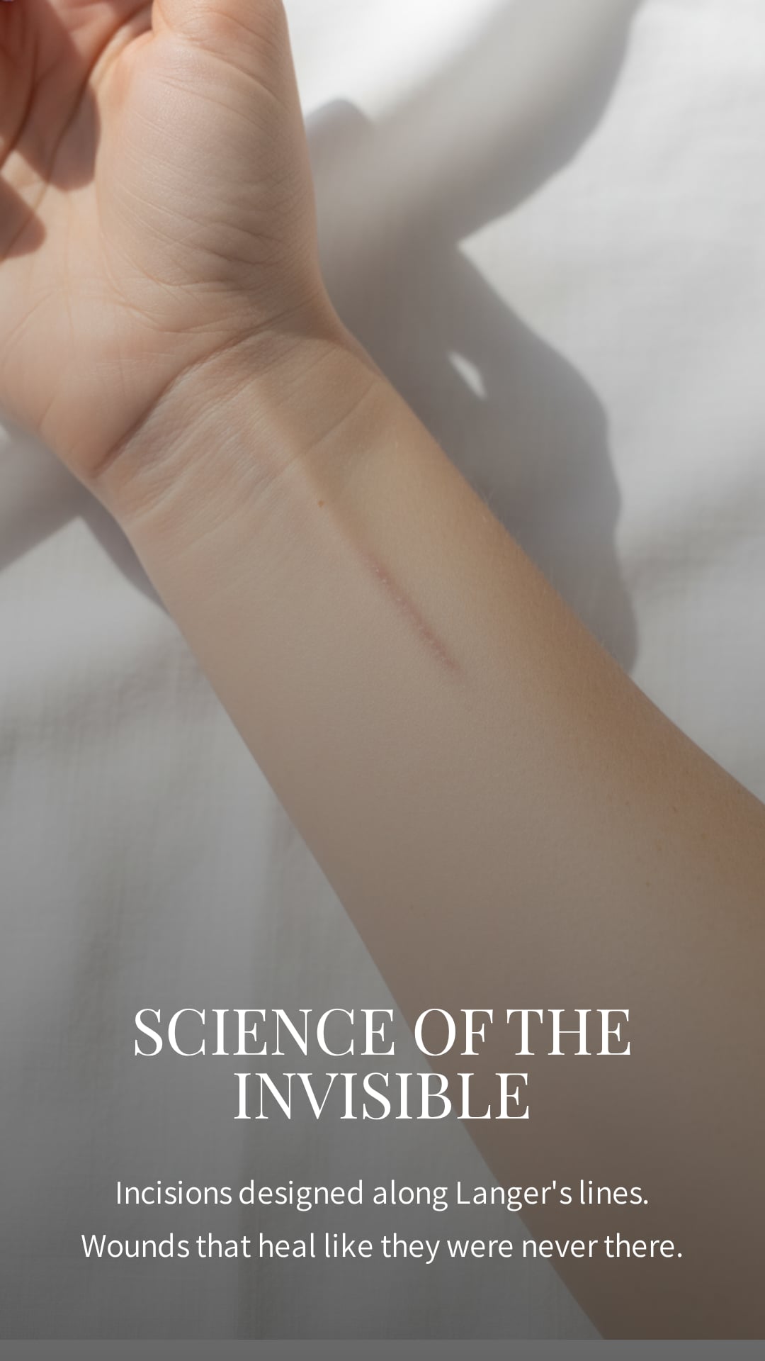 The Science of Invisible Scars. — Incisions designed along Langer's lines.