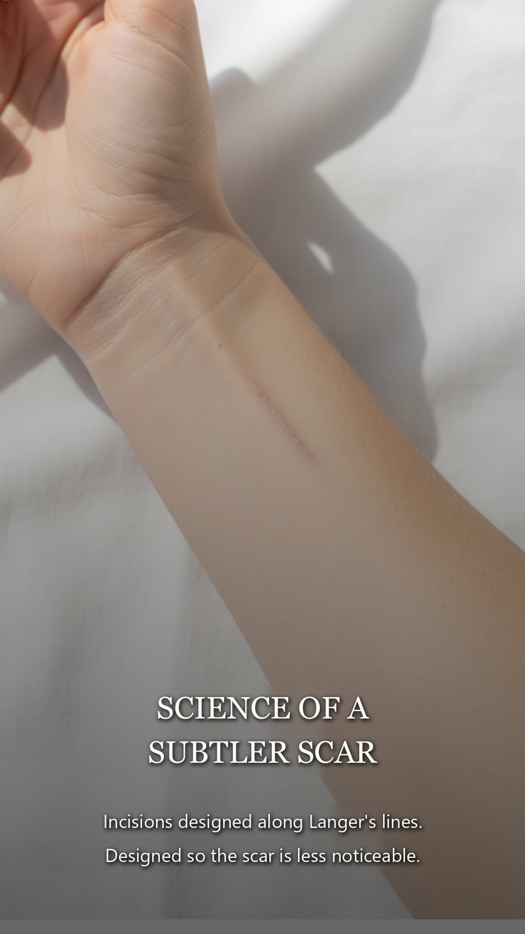 The Science of a Subtler Scar. — Incisions designed along Langer's lines.