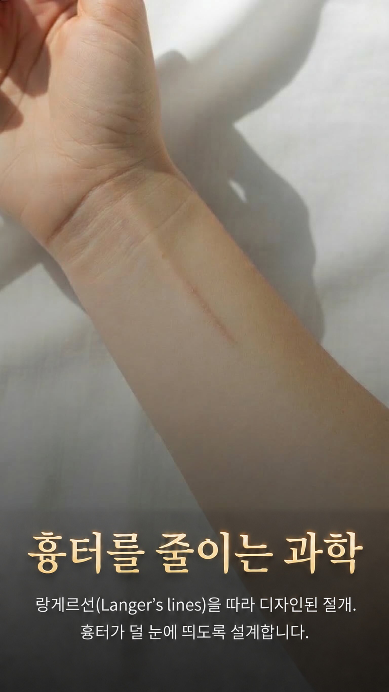 흉터를 줄이는 과학 — 랑게르선을 따라 디자인된 절개.