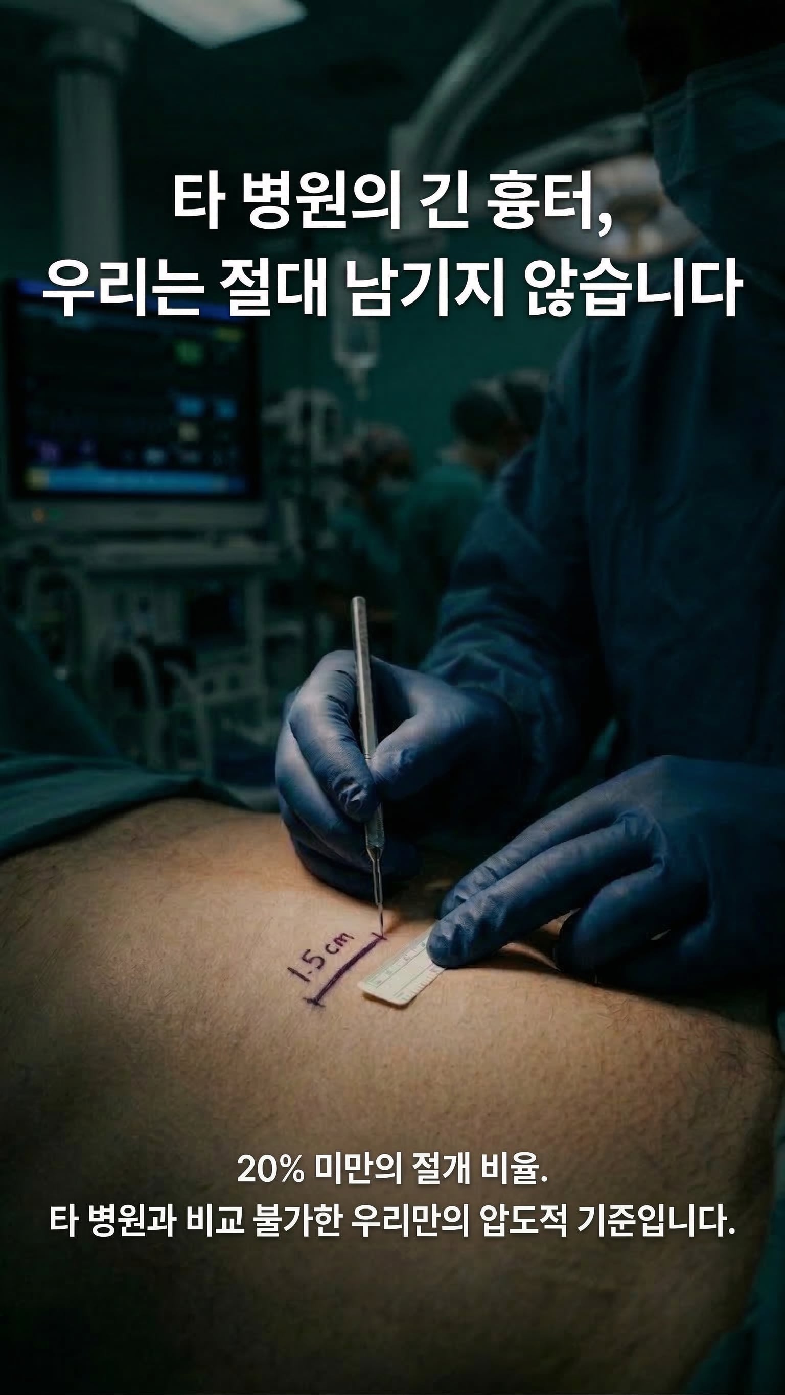 타 병원의 긴 흉터, 우리는 절대 남기지 않습니다 — 20% 미만의 절개 비율.