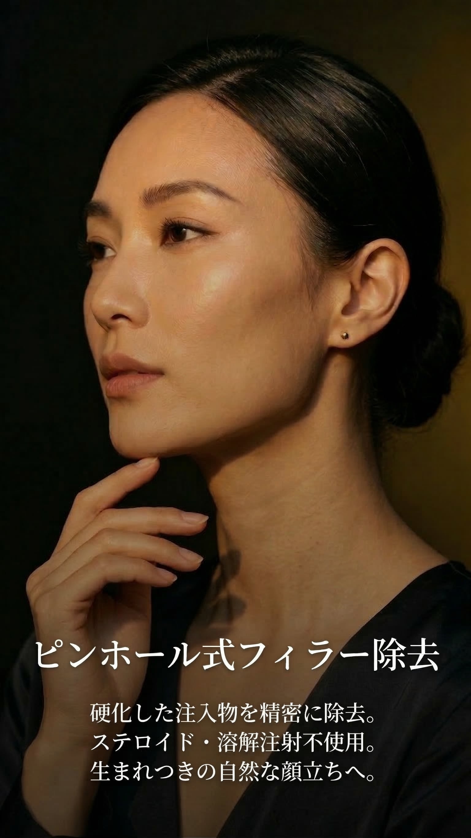 ピンホール式フィラー除去 — 硬化した注入物を精密に除去。