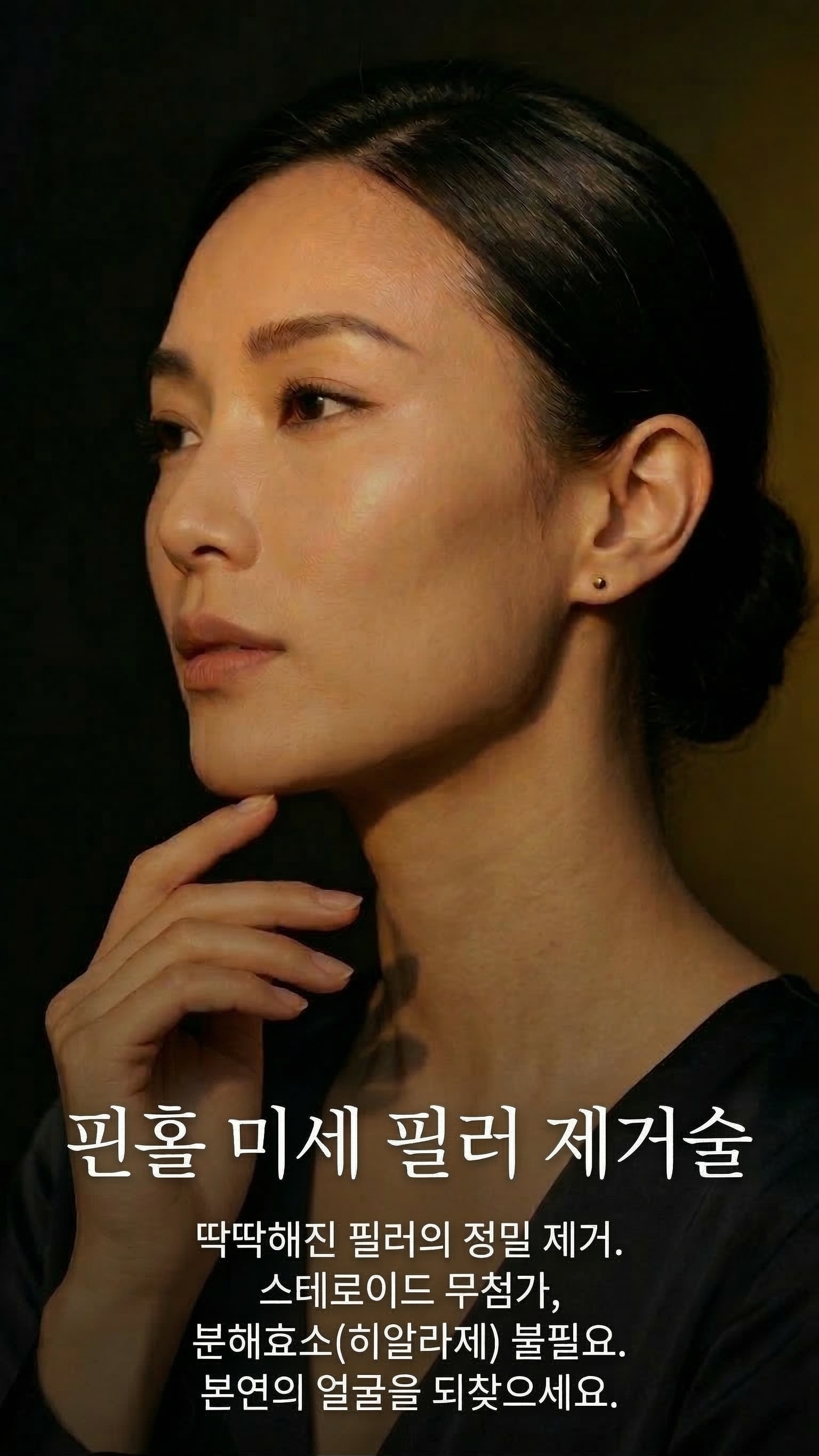 핀홀 미세 필러 제거술 — 딱딱해진 필러의 정밀 제거.