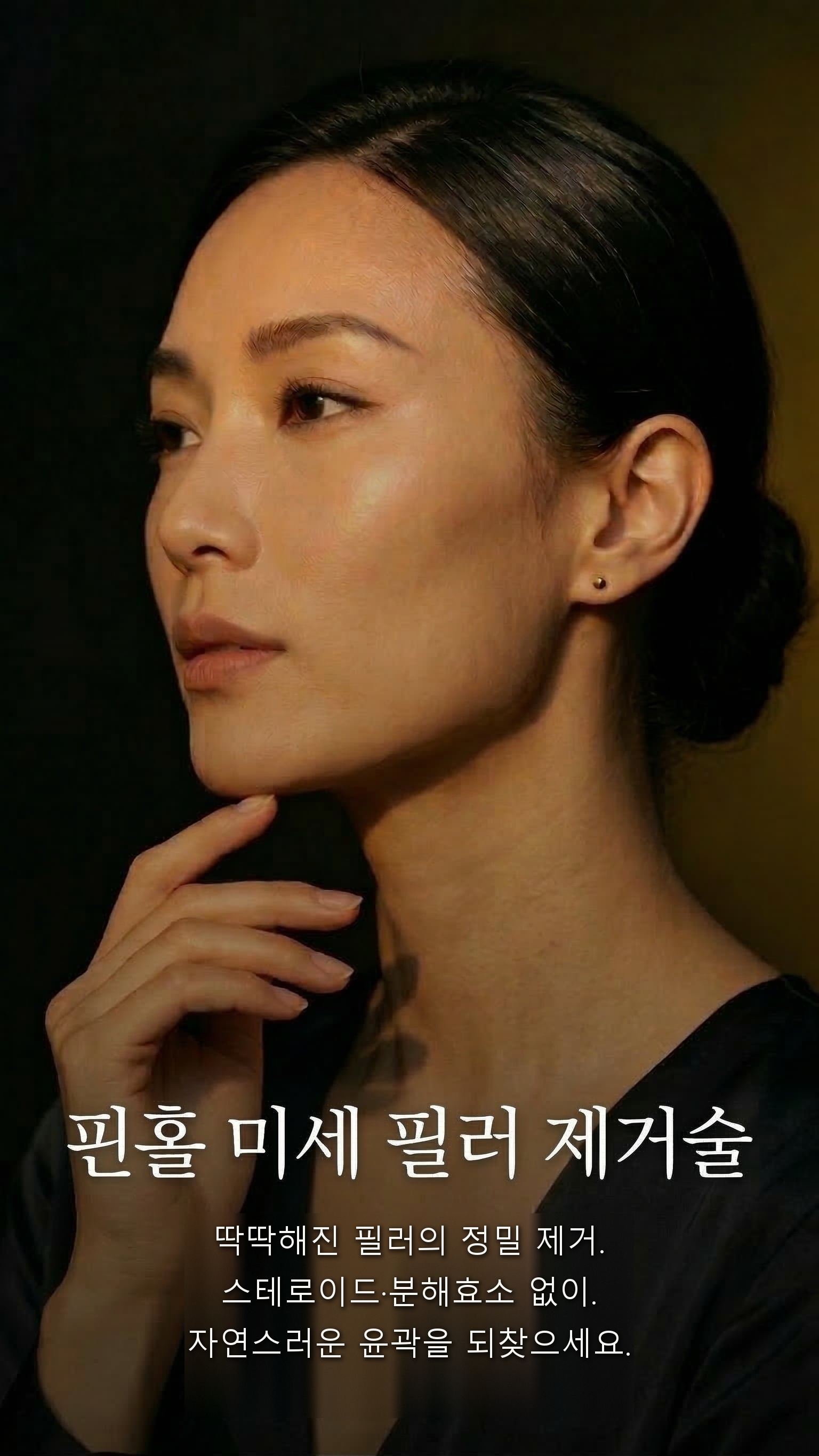 핀홀 미세 필러 제거술 — 딱딱해진 필러의 정밀 제거.
