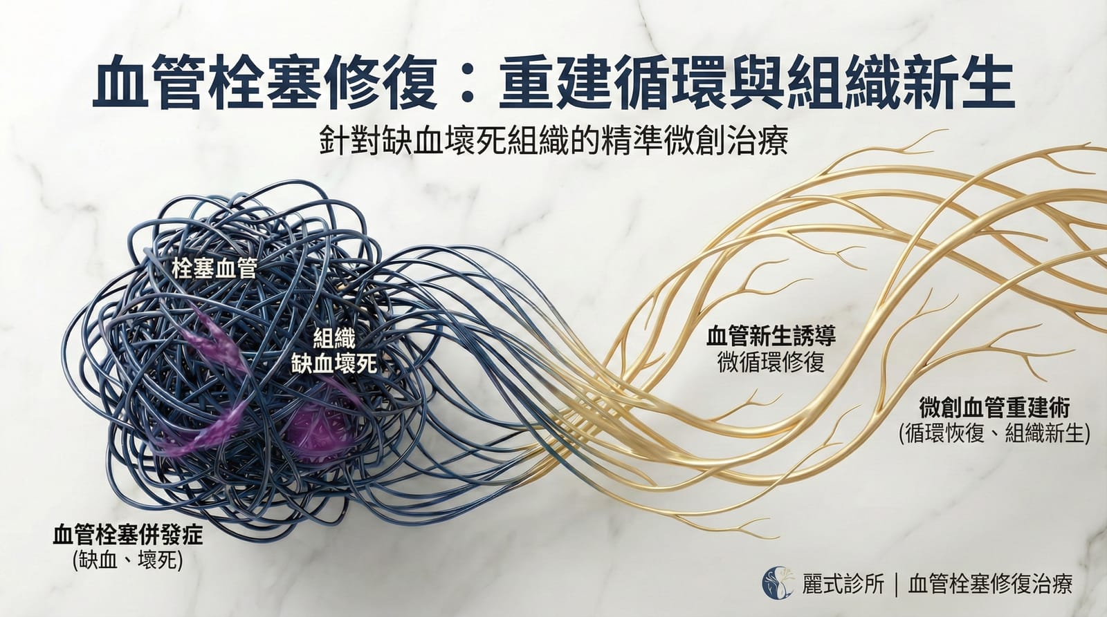 血管栓塞後修復